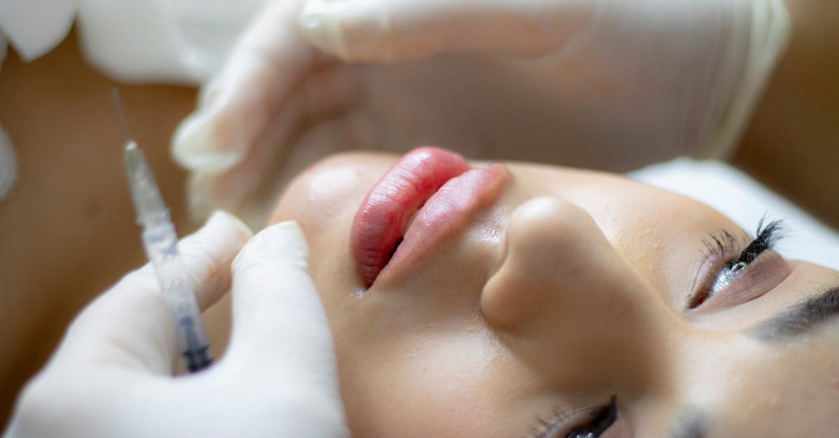 Cover Image for Lip Fillers Guide: Best Options, Costs & What to Know