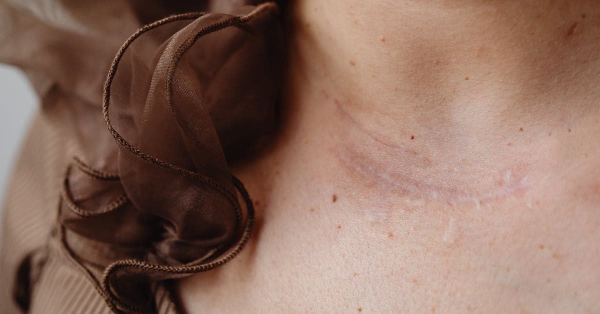 Cover Image for Scar Removal Guide: Best Treatments Compared